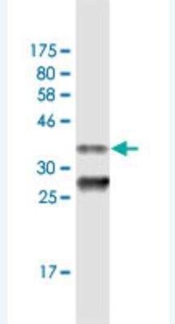 PEX3 Antibody (3C2), Novus Biologicals 0.1 mg | Buy Online | Novus Biologicals | Fisher Scientific