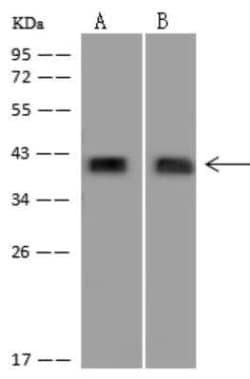 PEX3 Antibody, Novus Biologicals 50 &mu;g; Unconjugated:Antibodies, Polyclonal