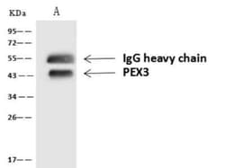 PEX3 Antibody, Novus Biologicals 50 &mu;g; Unconjugated:Antibodies, Polyclonal
