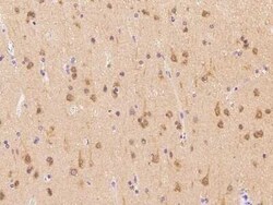 PFDN1 Antibody, Novus Biologicals 50 &mu;g, Unconjugated:Antibodies, Polyclonal