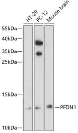 PFDN1 Antibody - Azide and BSA Free, Novus Biologicals:Antibodies:Primary