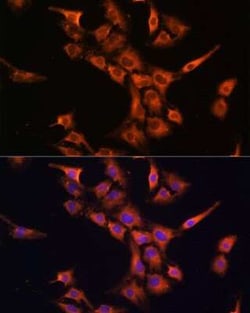 PFDN5 Antibody - Azide and BSA Free, Novus Biologicals 0.1 mL; Unconjugated:Antibodies,