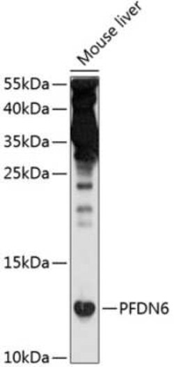 PFDN6 Antibody - BSA Free, Novus Biologicals 0.1 mL; Unconjugated:Antibodies,