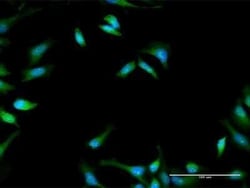 PFKFB1 Antibody, Novus Biologicals 0.1 mg | Buy Online | Novus Biologicals | Fisher Scientific
