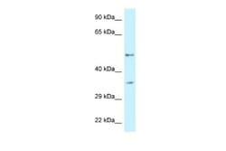 PFKFB1 Rabbit anti-Human, Polyclonal, Novus Biologicals 0.1ml; Unconjugated:Antibodies,