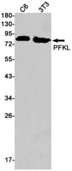 PFKL Antibody (S04-7A4), Novus Biologicals 50 &mu;g; Unconjugated:Antibodies,