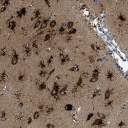 PFKP Antibody, Novus Biologicals:Antibodies:Primary Antibodies