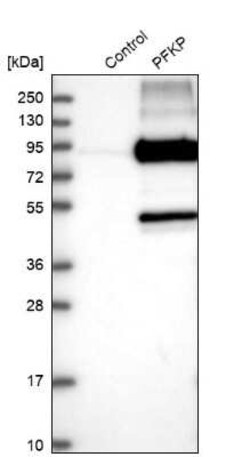 PFKP Antibody, Novus Biologicals:Antibodies:Primary Antibodies