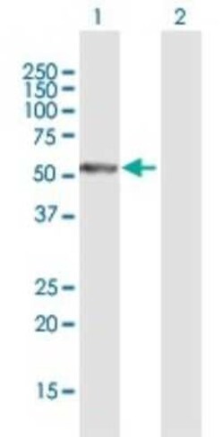 PFTK1 Antibody, Novus Biologicals 0.05 mg | Buy Online | Novus Biologicals | Fisher Scientific