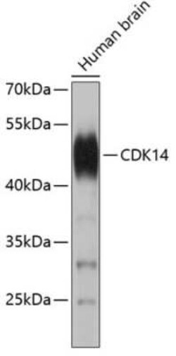 PFTK1 Antibody - Azide and BSA Free, Novus Biologicals 0.02 mL; Unconjugated:Antibodies,