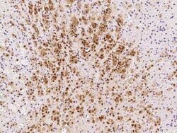 PGAM1 Antibody, Novus Biologicals:Antibodies:Primary Antibodies