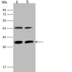 PGAM1 Antibody, Novus Biologicals:Antibodies:Primary Antibodies