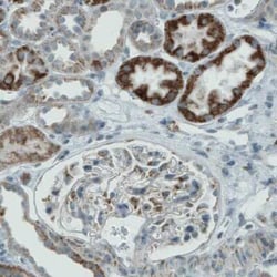 PGAM5 Antibody (CL0624), Novus Biologicals:Antibodies:Primary Antibodies