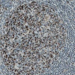 PGAM5 Antibody (CL0624), Novus Biologicals 0.1 mL, Unconjugated:Antibodies,