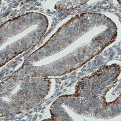 PGAM5 Antibody (CL0624), Novus Biologicals 0.1 mL, Unconjugated:Antibodies,