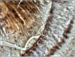 PGAP3 Antibody, Novus Biologicals 100 &mu;g | Buy Online | Novus Biologicals | Fisher Scientific