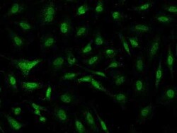 PGBD4 Antibody, Novus Biologicals 50 &mu;g, Unconjugated:Antibodies, Polyclonal