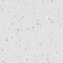 PGCP Antibody, Novus Biologicals 0.1 mL; Unconjugated:Antibodies, Polyclonal