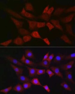 PGD Rabbit anti-Human, Mouse, Rat, Clone: 9A2M7, Novus Biologicals 20 &mu;g;