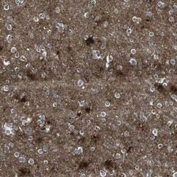 PGD2 Synthase/PTGDS Antibody, Novus Biologicals 0.1 mL | Buy Online | Novus Biologicals | Fisher Scientific