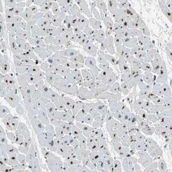 PGD2 Synthase/PTGDS Antibody, Novus Biologicals 0.1 mL | Buy Online | Novus Biologicals | Fisher Scientific