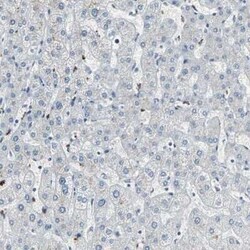PGD2 Synthase/PTGDS Antibody, Novus Biologicals 0.1 mL | Buy Online | Novus Biologicals | Fisher Scientific