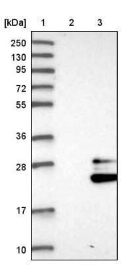 PGD2 Synthase/PTGDS Antibody, Novus Biologicals 0.1 mL | Buy Online | Novus Biologicals | Fisher Scientific
