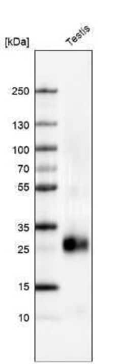 PGD2 Synthase/PTGDS Antibody, Novus Biologicals 0.1 mL | Buy Online | Novus Biologicals | Fisher Scientific