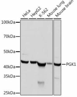 PGK1 Rabbit anti-Human, Mouse, Rat, Clone: 4B3Q3, Novus Biologicals 20