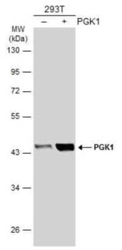 PGK1 Antibody (GT21612), Novus Biologicals 100 &mu;g; Unconjugated:Antibodies,