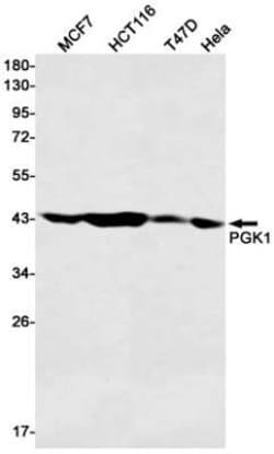 PGK1 Rabbit anti-Human, Mouse, Rat, Clone: S04-9H9, Novus Biologicals 100