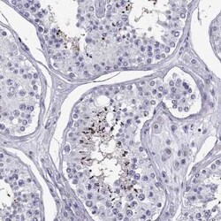 PGK2 Antibody, Novus Biologicals:Antibodies:Primary Antibodies