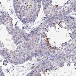 PGK2 Antibody, Novus Biologicals:Antibodies:Primary Antibodies