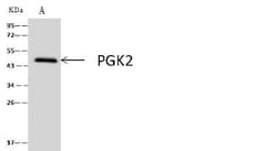 PGK2 Antibody, Novus Biologicals 50 &mu;g; Unconjugated:Antibodies, Polyclonal