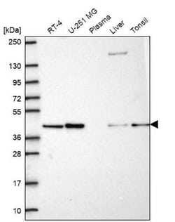 PGK2 Antibody, Novus Biologicals:Antibodies:Primary Antibodies