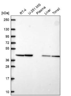 PGK2 Antibody, Novus Biologicals:Antibodies:Primary Antibodies