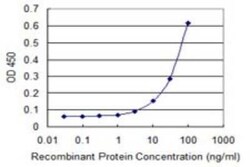 PGLS Antibody (2D9), Novus Biologicals 0.1 mg | Buy Online | Novus Biologicals | Fisher Scientific