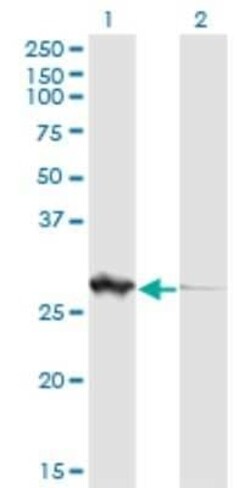 PGLS Antibody (2D9), Novus Biologicals 0.1 mg | Buy Online | Novus Biologicals | Fisher Scientific