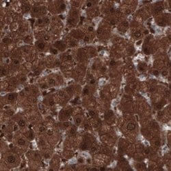 PGM1 Antibody (CL3299), Novus Biologicals 100&mu;L:Antibodies, Monoclonal