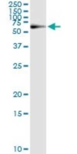 PGM1 Antibody (3B8-H4), Novus Biologicals 0.1 mg | Buy Online | Novus Biologicals | Fisher Scientific