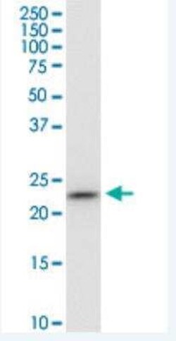 PGRMC1 Antibody (3F7), Novus Biologicals 100 &mu;g | Buy Online | Novus Biologicals | Fisher Scientific