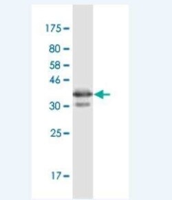 PGRMC1 Antibody (3F7), Novus Biologicals 100 &mu;g | Buy Online | Novus Biologicals | Fisher Scientific