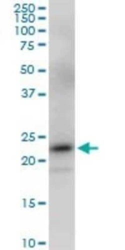 PGRMC2 Antibody (2A3), Novus Biologicals 0.1 mg | Buy Online | Novus Biologicals | Fisher Scientific