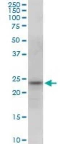 PGRMC2 Antibody (2A3), Novus Biologicals 0.1 mg | Buy Online | Novus Biologicals | Fisher Scientific