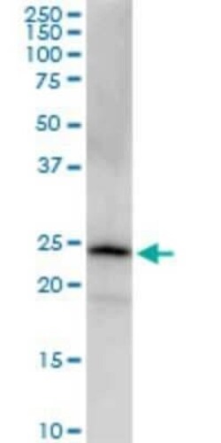 PGRMC2 Antibody (2A3), Novus Biologicals 0.1 mg | Buy Online | Novus Biologicals | Fisher Scientific