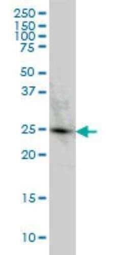 PGRMC2 Antibody (3C11), Novus Biologicals 0.1 mg | Buy Online | Novus Biologicals | Fisher Scientific