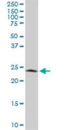 PGRMC2 Antibody (3C11), Novus Biologicals 0.1 mg | Buy Online | Novus Biologicals | Fisher Scientific