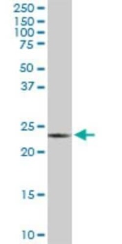 PGRMC2 Antibody (3C11), Novus Biologicals 0.1 mg | Buy Online | Novus Biologicals | Fisher Scientific