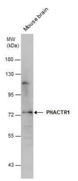 PHACTR1 Antibody, Novus Biologicals 100 &mu;g | Buy Online | Novus Biologicals | Fisher Scientific