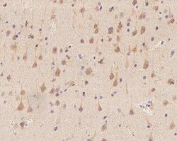 PHACTR3 Antibody, Novus Biologicals 50 &mu;g; Unconjugated:Antibodies,